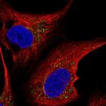 ST6GALNAC5 Antibody in Immunocytochemistry (ICC/IF)