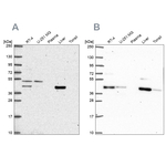 PHKG2 Antibody in Western Blot (WB)
