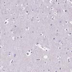 AIM Antibody in Immunohistochemistry (Paraffin) (IHC (P))