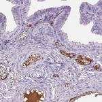 AIM Antibody in Immunohistochemistry (Paraffin) (IHC (P))