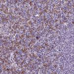 AIM Antibody in Immunohistochemistry (Paraffin) (IHC (P))