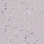 P2Y10 Polyclonal Antibody