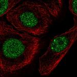 C1orf174 Polyclonal Antibody