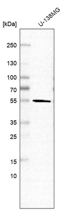 ETEA Antibody in Western Blot (WB)