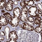 DHTKD1 Polyclonal Antibody