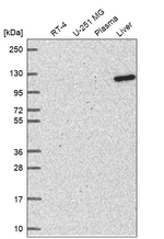 DHTKD1 Antibody in Western Blot (WB)