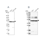 HADHB Antibody in Western Blot (WB)