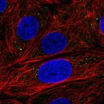 EDC3 Polyclonal Antibody