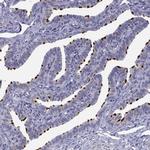 CCDC11 Antibody in Immunohistochemistry (Paraffin) (IHC (P))