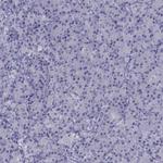 CCDC11 Polyclonal Antibody