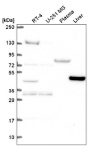 LDHD Antibody in Western Blot (WB)