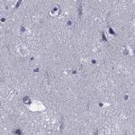 GKAP1 Antibody in Immunohistochemistry (Paraffin) (IHC (P))