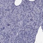 GKAP1 Antibody in Immunohistochemistry (Paraffin) (IHC (P))