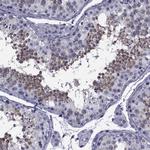 GKAP1 Antibody in Immunohistochemistry (Paraffin) (IHC (P))