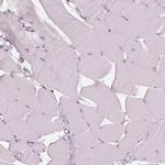 DNase II Polyclonal Antibody