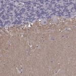 SLCO3A1 Polyclonal Antibody