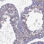 ZNF646 Antibody in Immunohistochemistry (Paraffin) (IHC (P))