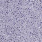 RIM2 Polyclonal Antibody