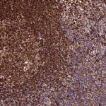 RNASET2 Polyclonal Antibody