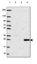 RNASET2 Antibody in Western Blot (WB)