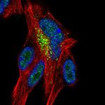 ZNF768 Polyclonal Antibody