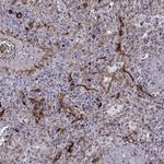NHERF2 Antibody in Immunohistochemistry (Paraffin) (IHC (P))