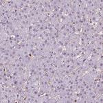 TIP47 Antibody in Immunohistochemistry (Paraffin) (IHC (P))
