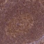TIP47 Antibody in Immunohistochemistry (Paraffin) (IHC (P))