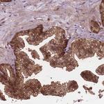 TIP47 Antibody in Immunohistochemistry (Paraffin) (IHC (P))