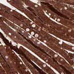 TIP47 Antibody in Immunohistochemistry (Paraffin) (IHC (P))