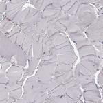 DOK2 Polyclonal Antibody