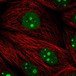 PES1 Antibody in Immunocytochemistry (ICC/IF)