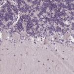 TMEM240 Antibody in Immunohistochemistry (Paraffin) (IHC (P))