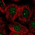 DOLK Polyclonal Antibody