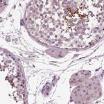 AP4M1 Antibody in Immunohistochemistry (Paraffin) (IHC (P))