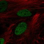 DPF3 Antibody in Immunocytochemistry (ICC/IF)