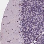 DPF3 Antibody in Immunohistochemistry (Paraffin) (IHC (P))