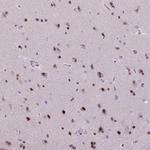 DPF3 Antibody in Immunohistochemistry (Paraffin) (IHC (P))