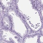 DPF3 Antibody in Immunohistochemistry (Paraffin) (IHC (P))