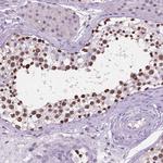 DPF3 Antibody in Immunohistochemistry (Paraffin) (IHC (P))