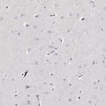 Neutrophil elastase Polyclonal Antibody