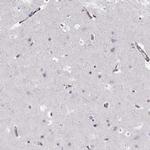 PGM5 Antibody in Immunohistochemistry (Paraffin) (IHC (P))
