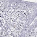 PGM5 Antibody in Immunohistochemistry (Paraffin) (IHC (P))