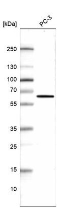 PGM5 Antibody in Western Blot (WB)
