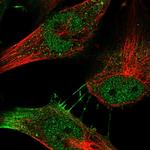 MYSM1 Polyclonal Antibody