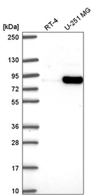 MYSM1 Antibody in Western Blot (WB)