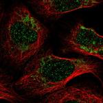 PET100 Antibody in Immunocytochemistry (ICC/IF)