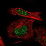 ITGB1BP1 Polyclonal Antibody