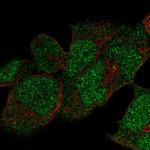 POLE Polyclonal Antibody