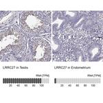 LRRC27 Antibody